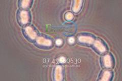 Cyanobacteria Coal Mining