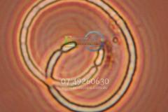 blue-green-algae-Hunter-Valley