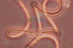 blue-green-algae-Port-Lincoln