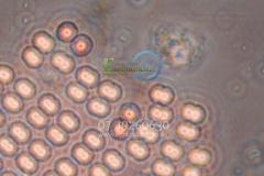 Katherine blue green algae cyanobacteria