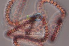 Penrith blue green algae cyanobacteria
