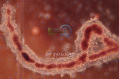 Mackay Cyanobacteria blue green algae