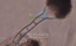 Mould impacts every aspect of your life.