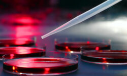 Hydrocabon Utilising Bacteria a must have for remediation.